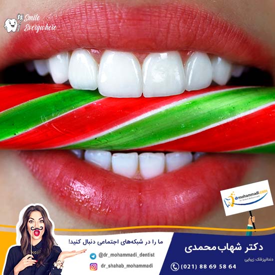 روش ساخت لمینت سرامیکی و نحوه تراش دندان برای لمینیت چگونه است؟ - کلینیک دندانپزشکی دکتر شهاب محمدی
